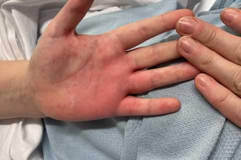 Doctors are STILL missing key signs of fatal condition that strikes kids weeks after Covid
