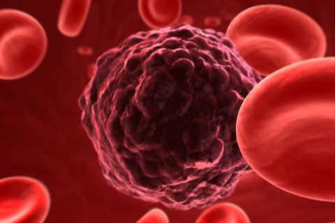 Head to toe… the most common signs that you could have cancer revealed