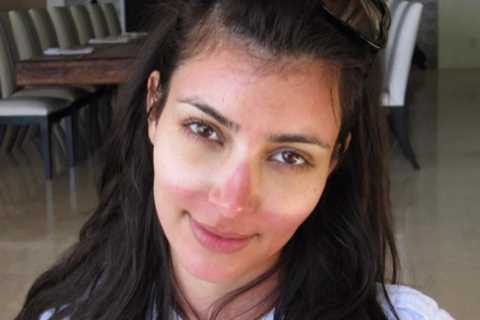 Kardashian fans love unfiltered &amp; candid photo of Kim with severe sunburn on her face in..