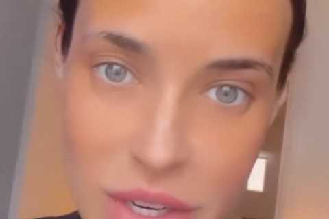 Stephanie Davis reveals painful skin reaction after fake tanning fail
