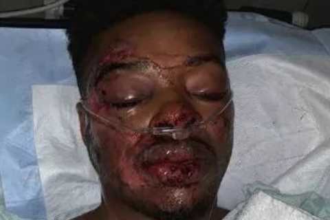 Errol Spence Jr suffers from PTSD after horror car crash and reveals he was in road smash just..