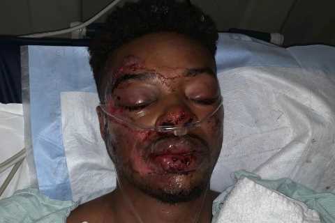 Errol Spence Jr refuses tune-up fights after car crash and eye injury and is one win away from..