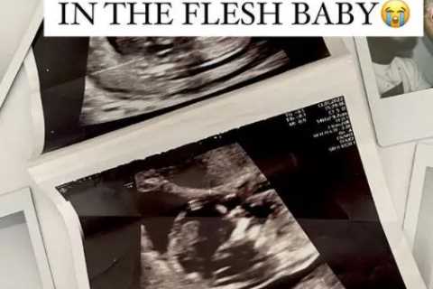 Love Island’s Zara McDermott shares surprise pregnancy announcement – and leaves fans seriously..
