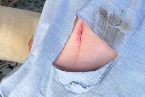 Pioneer Woman Ree Drummond’s husband Ladd suffers brutal injury after he’s ‘run over by a COW’