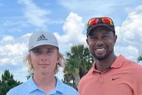 Rare photo shows true extent of Tiger Woods’ horror leg injury with fans amazed golf legend can..