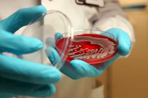Superbugs could trigger health crisis worse than Covid, experts warn