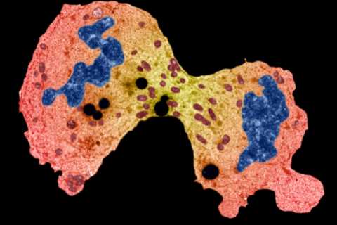 What is sarcoma and what is the survival rate of the cancer?