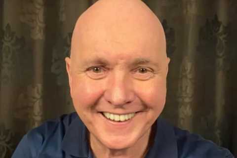 Why is Neighbour’s Alan Fletcher bald?