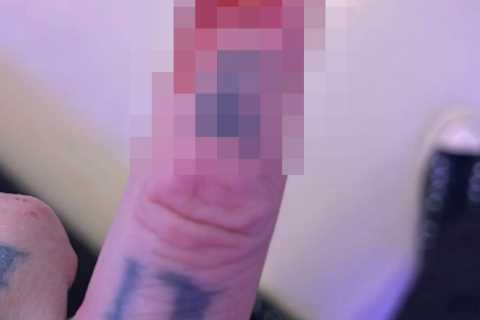 Kourtney Kardashian’s husband Travis Barker shares gruesome photo of his finger covered in blood..