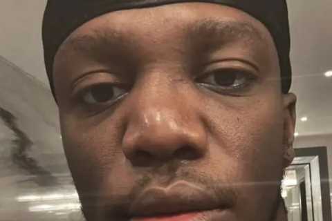 KSI shows off gruesome broken nose but British YouTube star still set to fight Alex Wassabi in..