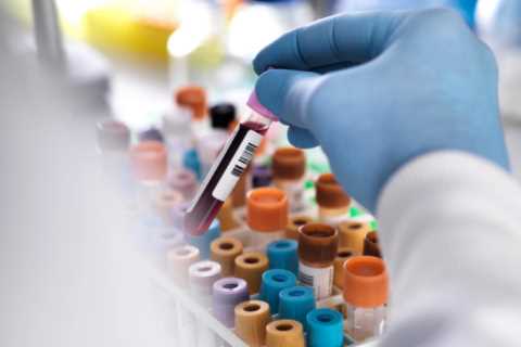 Simple blood test could detect early breast cancer for young women in scientific breakthrough