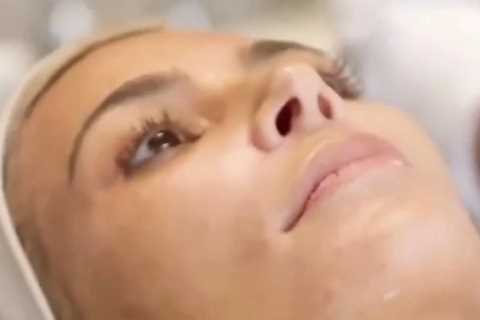 Kim Kardashian shows off real skin with ‘fine lines, dry cracked lips &amp; irritated blemishes’ in ..