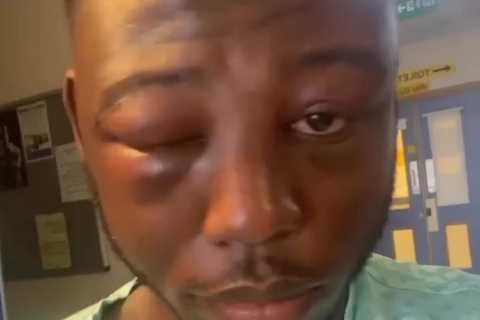 Isaac Chamberlain left almost unrecognisable and shows off ‘battle scars’ following epic fight with ..