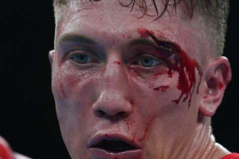 Commonwealth Games boxer Billy McAllister suffers horror cut from clash of heads that sees bout..