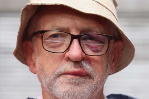 Jeremy Corbyn sports painful black eye and swollen lip after tripping over tree root while on a run