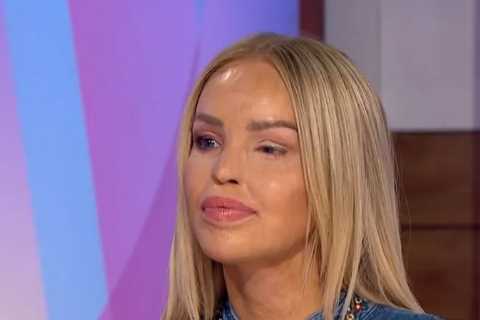 Katie Piper returns to Loose Women after major surgery, revealing tissue from donor was used to fix ..