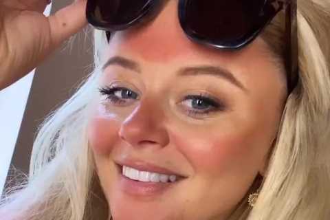 Emily Atack shows off awkward ‘tan line fail’ after holiday to Spain
