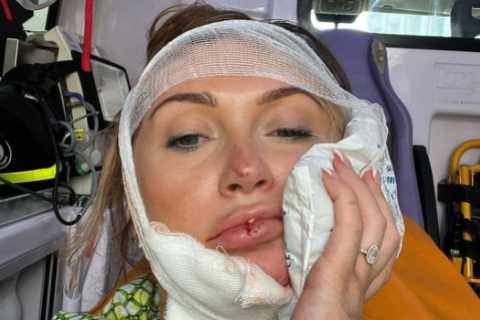 Charlotte Dawson rushed to hospital in Rome after nasty scooter accident