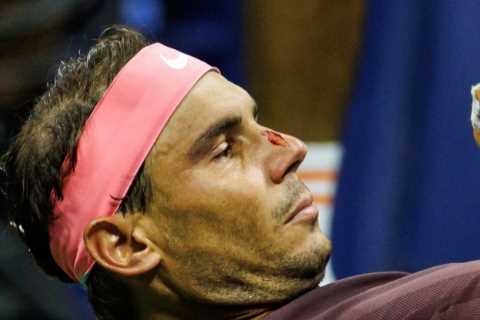 Watch Rafa Nadal whack his own face with tennis racket and leave himself bloodied and dazed on..