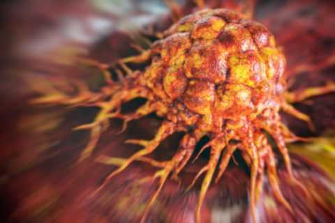 Urgent warning as cases of cancer surge in under 50s – the 11 signs you must never ignore