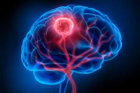 New drug could ‘cure’ aggressive brain cancer – stopping tumours in their tracks