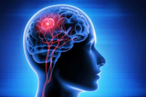 New treatment ‘cures’ aggressive brain cancer – stopping tumours in their tracks