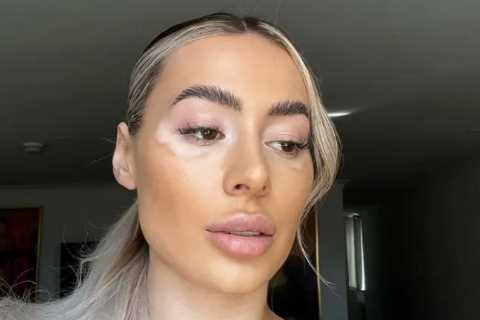 Towie’s Demi Sims strips topless in unfiltered photo as she celebrates her vitiligo