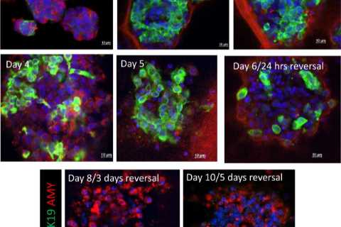 Incredible scans reveal how new drugs reverse deadliest cancer for first time