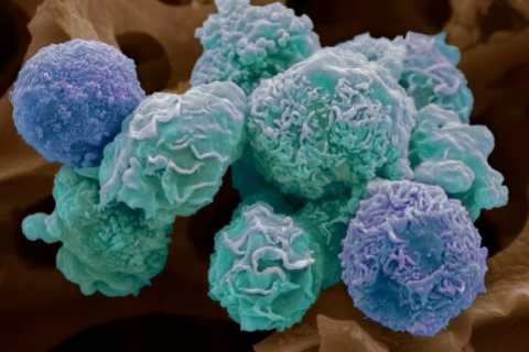 The 3 early warning sign of deadly cancer that can appear three years before diagnosis