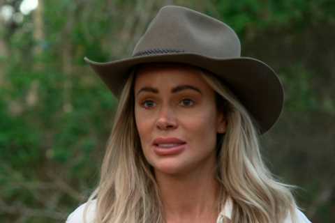 Olivia Attwood spent thousands on Botox and cosmetic treatments before shock I’m A Celebrity exit