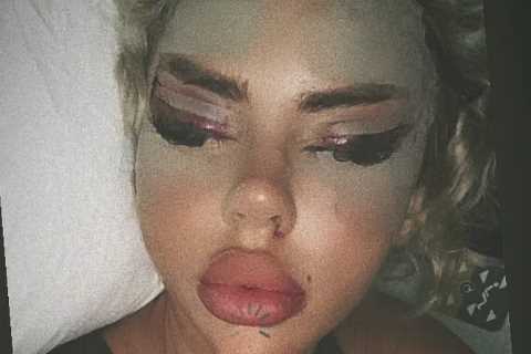 Love Island star Hannah Elizabeth reveals she ‘loves’ shocking result of face surgery saying she..
