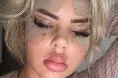Love Island’s Hannah Elizabeth shows off new face after shock new surgery