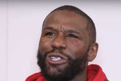 Watch Floyd Mayweather’s hilarious reaction to suffering a ‘black eye’ in exhibition fight with..