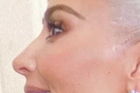 Kardashian fans mock Kim after new unedited photo uncovers star’s hidden ‘face tape’ used to lift..