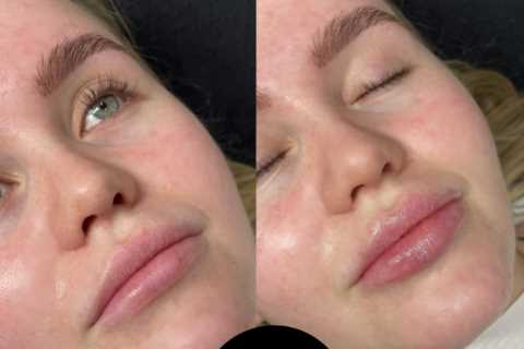 Gogglebox’s Georgia Bell reveals new lips after giving birth saying ‘I love them so much’