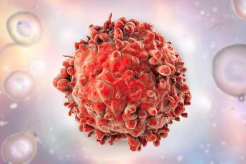 14 signs of deadliest cancer you’re most likely to ignore