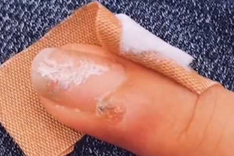 I was shocked when doctors said my manicure may have given me cancer – after nail tech was ‘too..