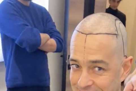 Pop singer looks unrecognisable as he shaves off famous curls before having hair transplant