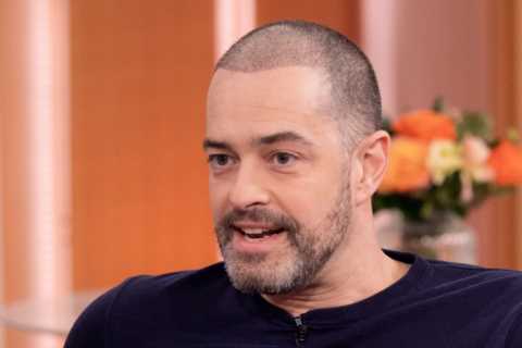 Lee Mead reveals shocking results of his hair transplant as he admits he’s had it done TWICE
