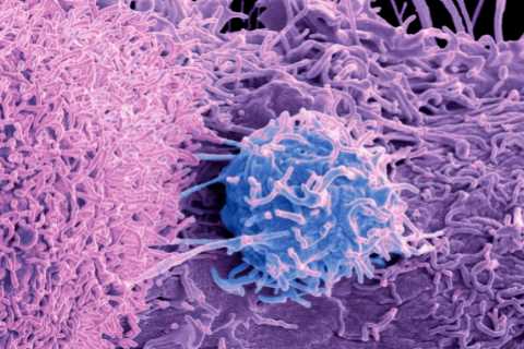 Man’s sudden Irish accent turns out to be bizarre symptom of prostate cancer in world-first