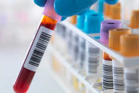 Breakthrough for prostate cancer as new simple blood test is 94% accurate