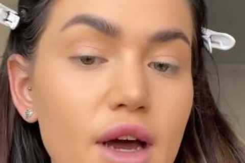 Dumped Love Island star Anna-May Robey getting lip fillers dissolved to look ‘more natural’