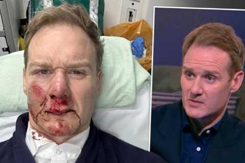 Dan Walker missing from 5News after horror accident as he says he’s ‘lucky to be alive’