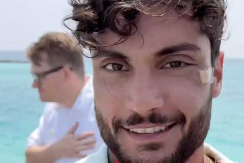 Love Island’s Davide shows off mystery injury after extending Maldives holiday and attempted break..