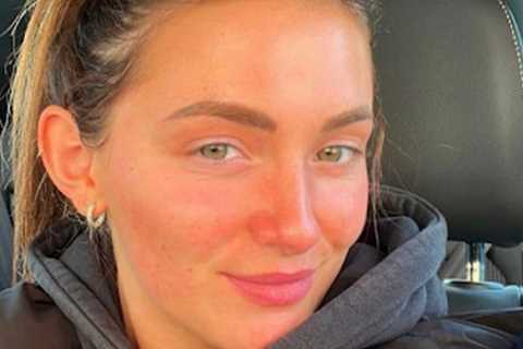 Emmerdale’s Rosie Bentham looks very different make-up free as she shows off natural beauty