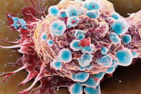Cancer breakthrough could stop tumours growing back years after treatment