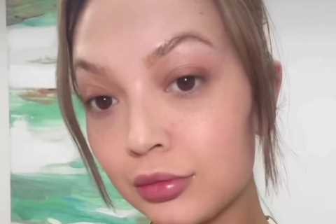 Love Island’s Sharon Gaffka shows off her ‘new lips’ after she gets fillers dissolved