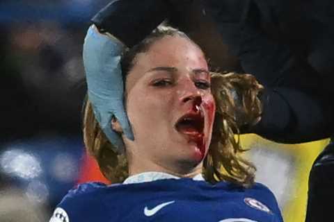 Chelsea star Melanie Leupolz forced off with nasty injury as blood streams down her face and fans..
