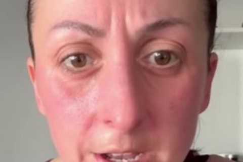EastEnders Natalie Cassidy looks slimmer than ever as she reveals ‘beetroot face’ after sweaty..