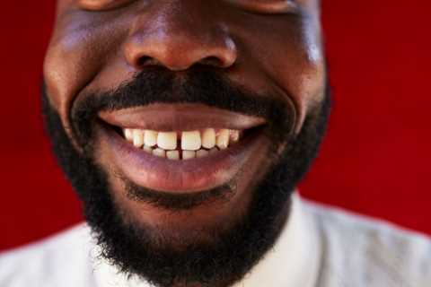 The sign of deadly cancer you can spot in your mouth – and 5 other ‘silent’ symptoms to look out for